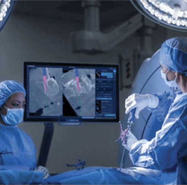 Sistema O-arm, visualización de cirugías de la columna vertebral en tiempo real